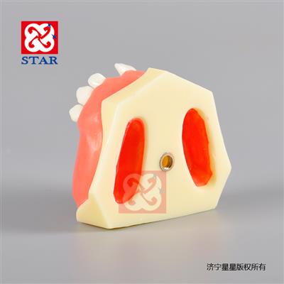 上頜竇提升練習下口種植