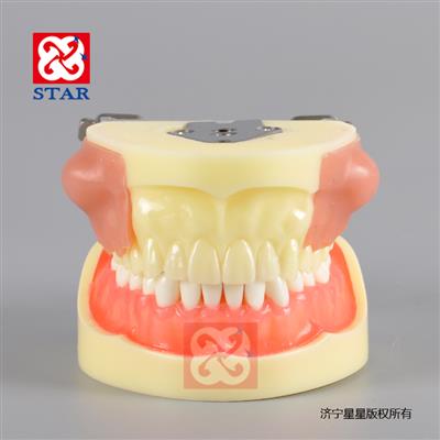 膿腫切開引流雙側膿腫塊